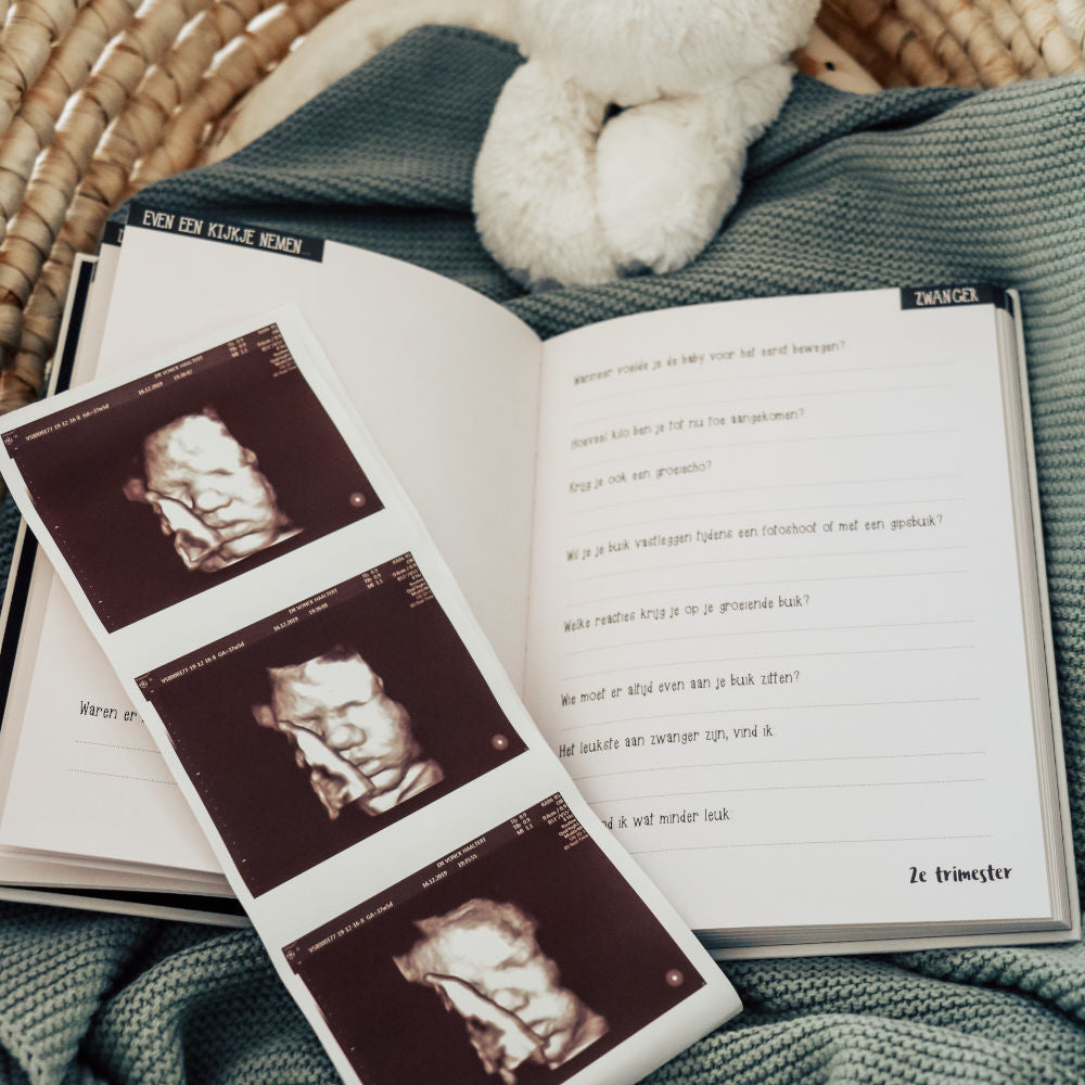 Zwangerschapsdagboek met echofoto's